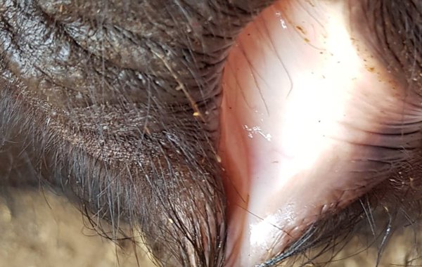 Babesiosis