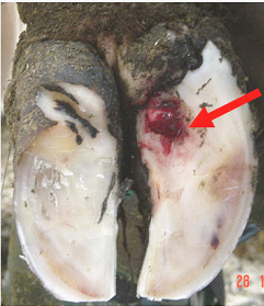 Sole ulceration