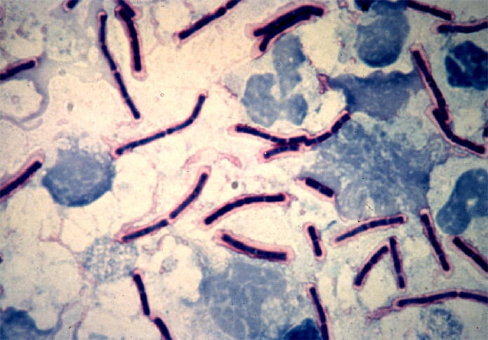 Bacillus anthracis