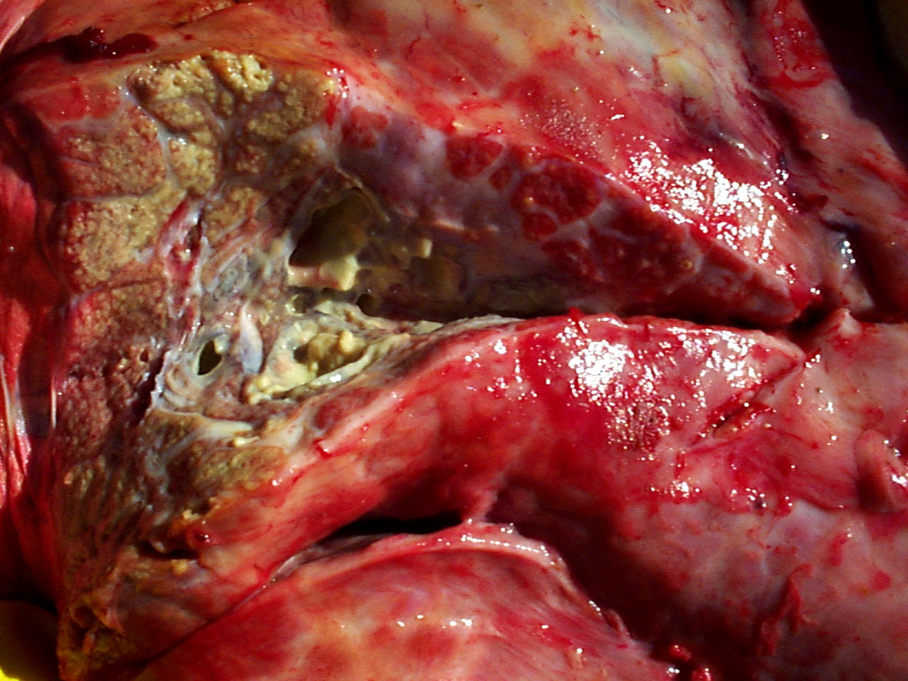 10 Chronic pneumonia secondary to BVDv invfection