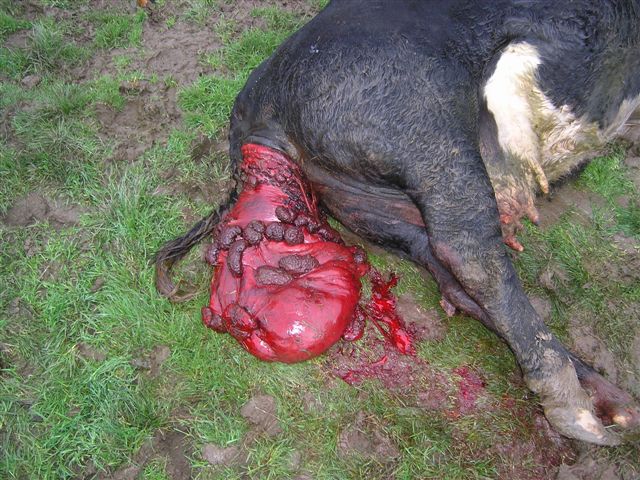 4 uterine prolapse